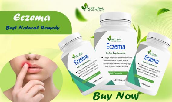 Home Remedies for Lip Eczema: Natural Solution for Soothing and Healing